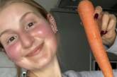 Шкіра дівчини стала помаранчевою через величезну кількість з'їденої моркви – фото