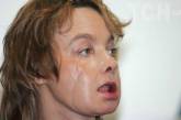 Жінка, якій вперше у світі зробили пересадження обличчя: трагічна історія Ізабель Дінуар