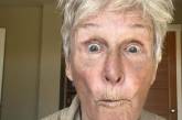 Актриса Гленн Клоуз напередодні свого 77-річчя зламала носа