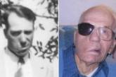 Чоловік, якому в дитинстві брат вистрелив в обличчя, прожив із кулею в голові 94 роки – фото