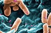 Вчені розібралися, як вбити супербактерії