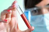 Исследователи установили связь между потенцией и группой крови мужчин