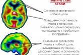 Панические атаки и тревожность связаны с дефицитом витамина В и железа