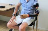57-летнему британцу вживили бионический протез с кучей насадок. ФОТО