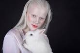 Интересные факты об альбиносах. ФОТО