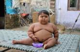 16-месячная девочка весит 25 кг.ФОТО