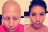 Люди, которые победили рак, на снимках до и после. ФОТО