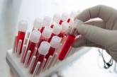 Ученые опровергли пользу переливания крови