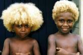 Каждый десятый темнокожий житель Меланезии — блондин. ФОТО