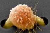 Британские учёные создали "нанокиллера" для раковых клеток