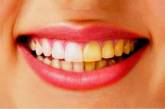 В чем причина желтизны зубов и как с ней справиться