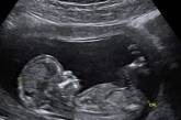 Джастин Бибер разыграл поклонников новостью о беременности Хейли Болдуин. ФОТО