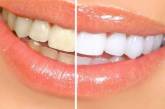 Стоматологи сообщили, кому опасно отбеливать зубы