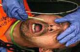 Голодающих узников Гуантанамо кормят через ноздри