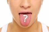 Медики рассказали, о каких симптомах говорит белый налет на языке