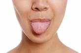 Медики рассказали, о чем сигнализирует распухший язык