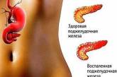 Панкреатит: как уберечь поджелудочную железу