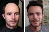 До и после: лысые мужчины посетили салон красоты. ФОТО