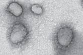 В Китае найден ближайший родственник вируса атипичной пневмонии