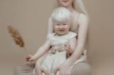 Сёстры-альбиносы родились с разницей в 12 лет и покорили мир моды своей уникальностью необычной внешностью. ФОТО