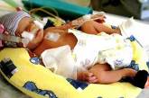 Медики спасли жизнь 275-граммового младенца