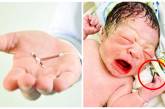 Младенец появился на свет, держа в руках контрацептив