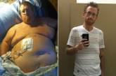 Американец думал, что лишний вес убьет его, записал предсмертное видео, а потом взял и похудел на 160 кг. ФОТО