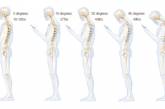 Врачи убеждены, что смартфоны очень вредны для вашего позвоночника