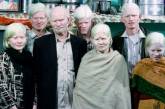 В Индии живет самая большая в мире семья альбиносов. ФОТО