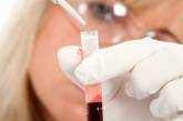 Что грозит женщинам с третьей группой крови?