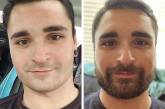Снимки мужчин покажут, что усы и борода круто меняют внешность (ФОТО)