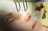 Фракционное омоложение кожи – может ли косметолог заменить пластического хирурга?