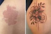 Кавер-ап татуировки, которые превратили изъяны кожи в произведения искусства (ФОТО)