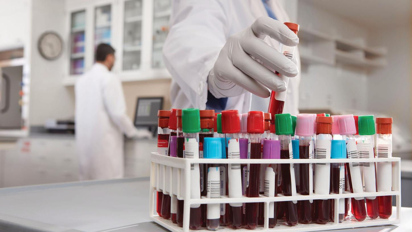 Четыре распространенные привычки, которые приводят к раку