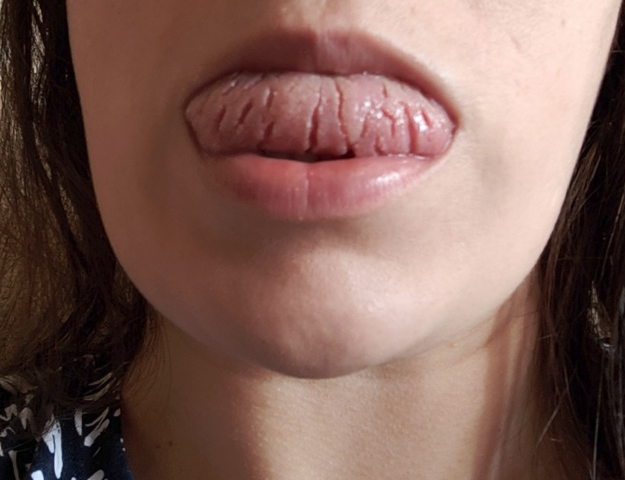 Дієтологи назвали найшкідливішу їжу, яку не варто їсти ніколи