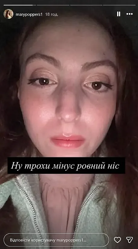 Оля Полякова рассказала о состоянии дочери после ДТП