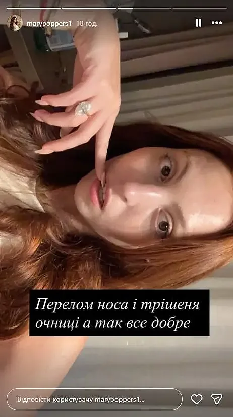 Оля Полякова рассказала о состоянии дочери после ДТП