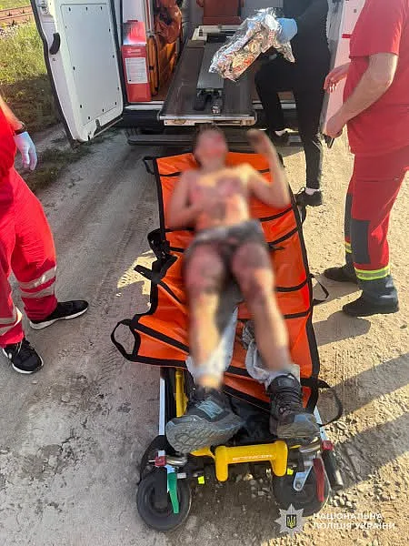 Во Львове 13-летний мальчик попал в реанимацию после попытки сделать селфи на вагоне