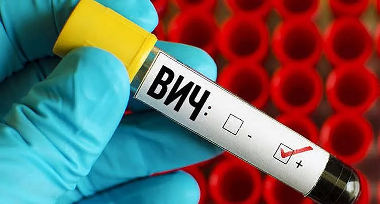 В Николаевской области растет число выявленных случаев ВИЧ: данные за сентябрь