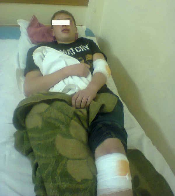 В Николаеве двое мужчин жестоко избили подростка: милиция до сих пор не опросила парня