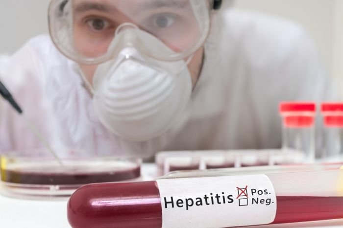 Вспышка гепатита в Николаеве: полная информация 