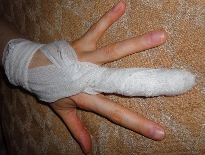 В Николаеве замдиректора зерноторговой компании сломал палец женщине-следователю