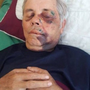 На Закарпатье жестоко избили 78-летнего настоятеля храма УПЦ