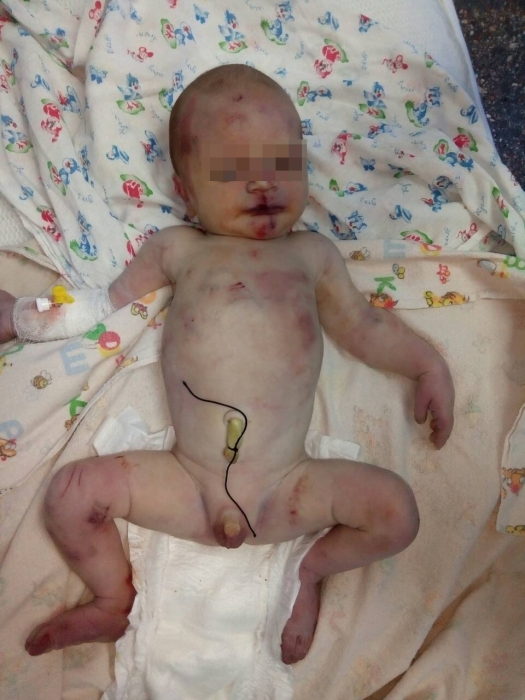 На Николаевщине неизвестные подбросили под больницу избитого новорожденного в коробке