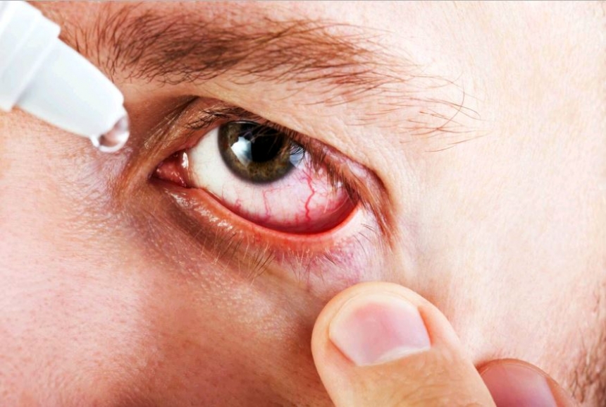 В Украине запретили популярное лекарство от воспаления глаз