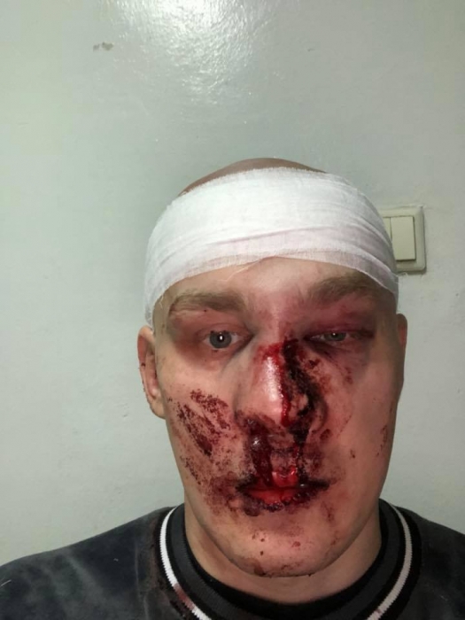 В Харькове экс-командира "Східного корпусу" жестоко избили на чемпионате Украины по боксу