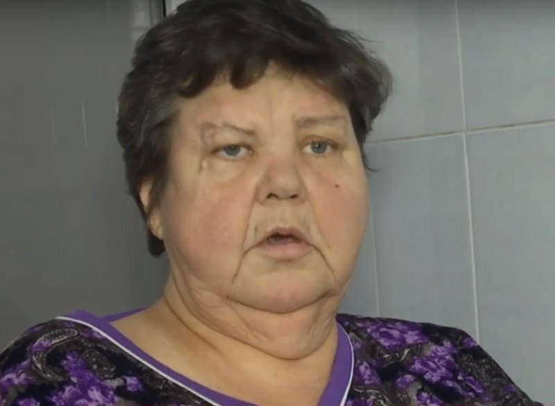«Ошибка врача»: у Савченко ответили, почему женщина на Николаевщине лишилась ноги