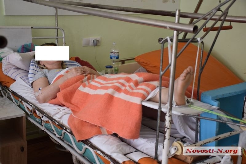 В Николаеве прооперировали сторонницу Вилкула, которой сломали ногу в агитпалатке