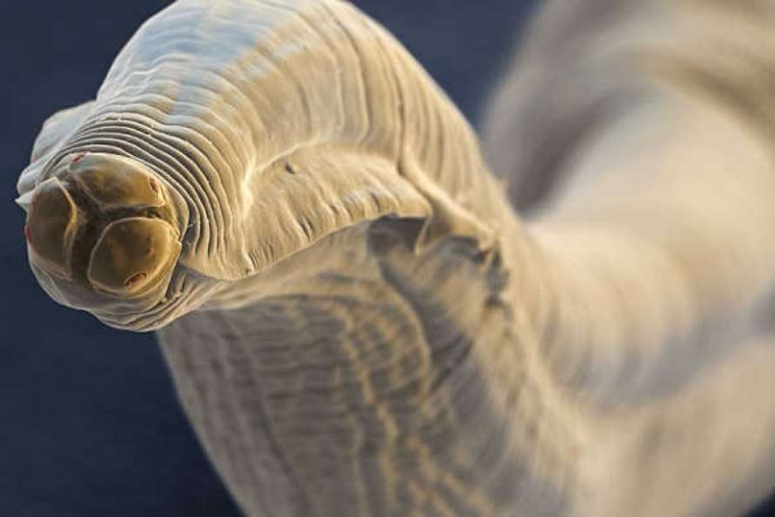 В каждом пятом жителе Земли живут черви-паразиты, – ученые