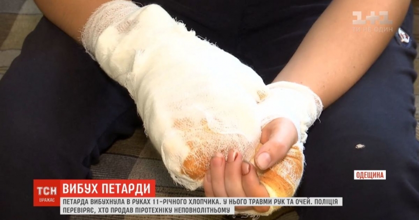 В Одессе в руках у ребенка взорвалась петарда: мальчик в больнице